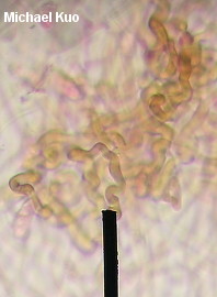 Dacryopinax elegans