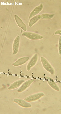 Lepiota magnispora