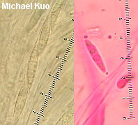 Ascocoryne cylichnium