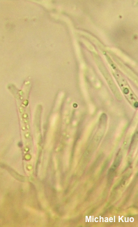 Guepiniopsis buccina