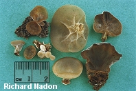 Auricularia auricula