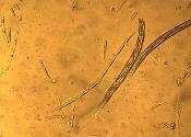 Tolypocladium longisegmentum ascus
