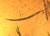 Tolypocladium longisegmentum ascus