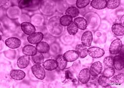 Cortinarius violaceus spores