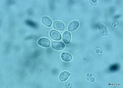 Hohenbuehelia mastrucata spores