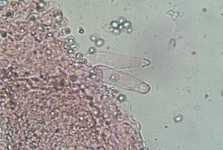 Pluteus longistriatus cystidia