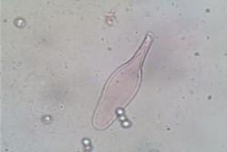 Pluteus longistriatus cystidia