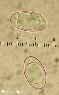 Sowerbyella rhenana