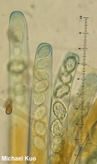 Rugosporella atrovinosa
