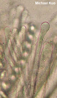Rugosporella atrovinosa