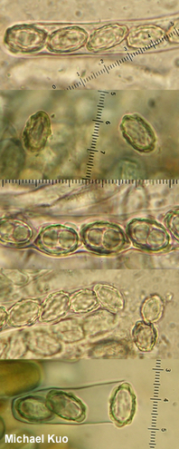 Rugosporella atrovinosa