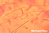 Albatrellus confluens