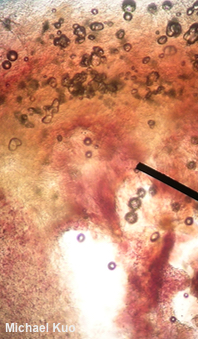 Callistosporium luteo-olivaceum