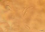 Urnula craterium ascospores