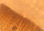 Urnula craterium paraphyses