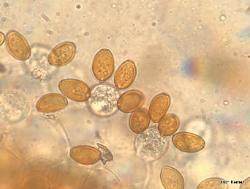 Conocybe apala basidia with spores