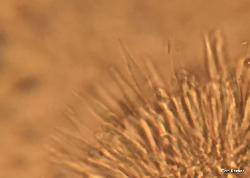 Lachnum virgineum paraphyses