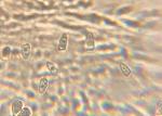 Lepiota cristata spores