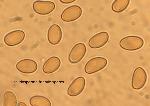 Pseudosperma friabile spores