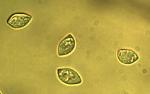 Xerula megalospora spores