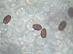 Coprinopsis variegata spores