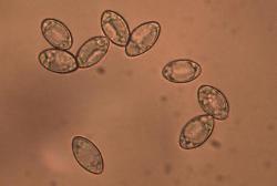 Helvella macropus spores