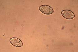 Helvella macropus spores