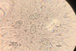 Paragalactinia succosa ascospores