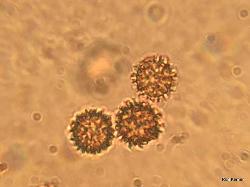 Pisolithus arenarius spores