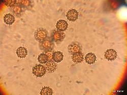 Pisolithus arenarius spores