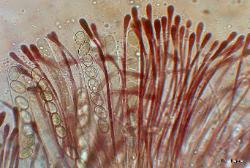 Scutellinia asci and paraphyses
