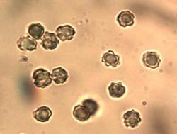 Thelephora vialis spores