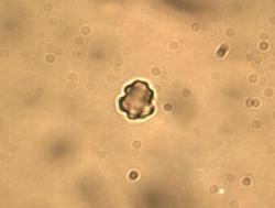 Thelephora vialis spores
