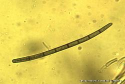 Trichoglossum walteri spore