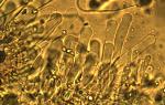 cheilocystidia of Xerula megalospora