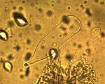 pleurocystidium of Xerula megalospora