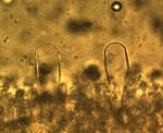 pleurocystidia of Xerula megalospora